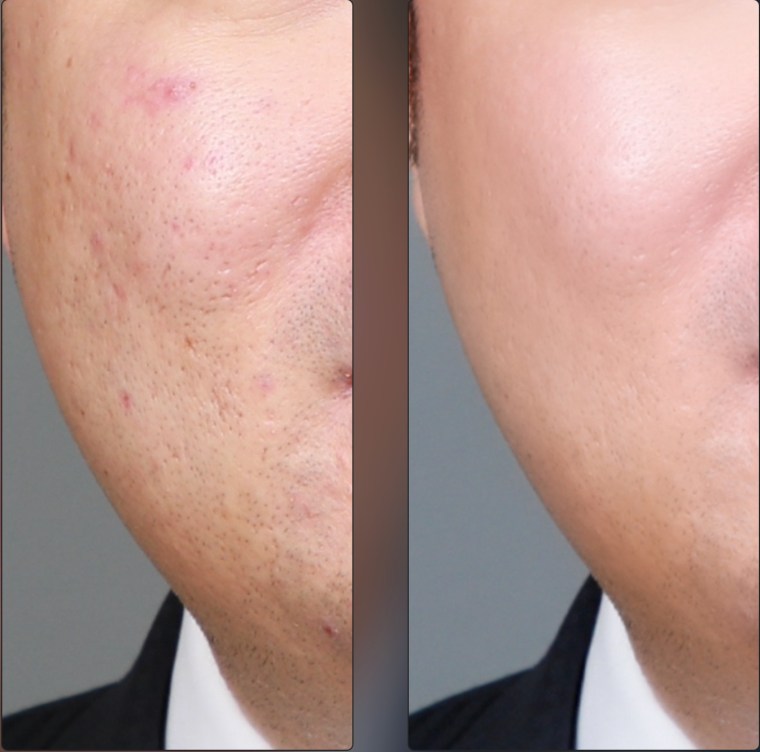 photo edit cv photo before and after icefire studio1s